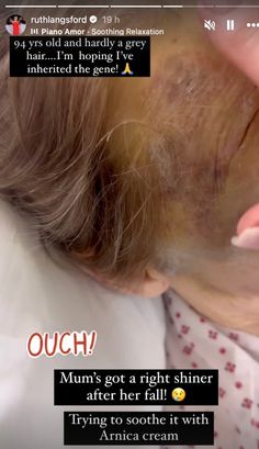 RUTH Langsford has shared a look at her elderly’s mum face bruising after a nasty fall saw her taken to hospital. Joan, 94, suffered a recent fall and broke her pelvis, with Ruth keeping her social media followers in the loop on her recovery. And in the most recent update, Loose Women’s Ruth, 65, shared a look at her […]