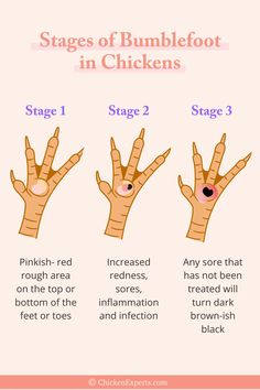 stages of bumblefoot in chickens info graphic by chickenpops on devisy