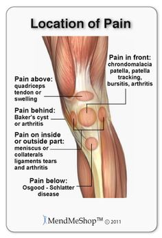 Don't let slight inflammation stop you from your goals, strengthening and ice can work out the kinks! Knee Ligament Injury, Ligament Injury, Knee Injury, Sciatica