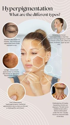 Reachable beauty Pigmentation On Face, Hyperpigmentation Remedies, Facial Light Therapy, Vitamins For Healthy Skin, Skin Quotes, Skin Studio, Botox Filler, Beauty Skin Quotes, Forehead Acne