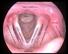 the inside of an adult's mouth with different parts labeled in red and white