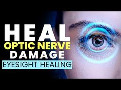 Optic Nerve Damage, Healing Eyesight, Eye Nerves, Eye Health Remedies, Eyes Health, Healthy Vision, Healing Tones, Optic Nerve