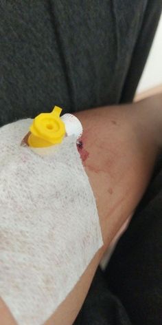 a person with bandages and a yellow button on their arm