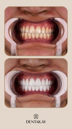 Dental Makeover, Dental Wallpaper, Dental Smile, Dental Posters, General Dentistry, Hospital Design, Good Day Quotes