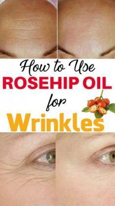 How to Use Rosehip Oil for Wrinkles & Eye Wrinkles – 5 Methods – Page 8 Beauty Hacks That Actually Work, Coffee Facial, Herzogin Von Cambridge, Eye Wrinkles, Home Remedies For Hair, Rosehip Seed Oil, Eye Wrinkle, Natural Therapy, Ipad App