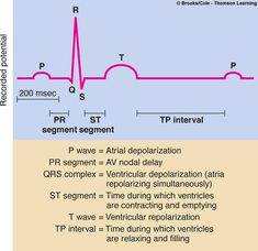 deflection point generated by ventricular repolarization | wave - atrial depolarization Paramedic School, Nursing Mnemonics, Cardiac Nursing, Nursing School Notes, Medical School Essentials