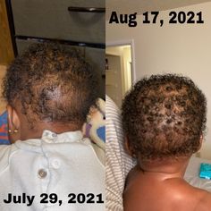 Baby A.G.H. Benefits Reduces or completes rids the hair and scalp of cradle cap Grows the hair Baby A.G.H. Directions Apply the dropper into the child's scalp Use this hair oil 2-3 times a day Massage the oil into the scalp thoroughly Ingredients Eucalyptus oil Mandarin oil Other natural essential oils Hair Oil For Dry Scalp, Lil Boy Haircuts, Oil For Dry Scalp, Dry Flaky Scalp, Oil For Curly Hair, Mommy Ideas, Natural Shampoo And Conditioner, Baby Boy Hairstyles, Help Hair Grow