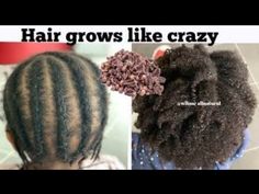 The right way to use Clove Water For Unstoppable Hair Growth - YouTube Cloves Benefits For Hair, Clove Water Benefits, Cloves For Hair Growth Diy, Cloves And Coconut Oil For Hair, Clove Water For Hair Growth, Hair Growrh, Clove Water, Ancient Hair Growth Secrets, Ginger Hair Growth