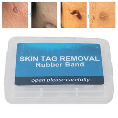 Feature:1. Bundling the root of the skin tag, so that it can not absorb the blood moisture and nutrients to stop growth, then atrophy and fall off. 2. Band will tighten onto the base of the skin tag to prevent the blood supply, which will cause the skin tag to fall off several days. 3. Quick, painless remove skin tag and can be used on all small to medium sized skin tags. 4. No need expensive, painful cosmetic or dermatological procedure, just one simple step to remove skin tags. 5. This product needs to be used with skin tag remover device together, easy to remove skin tags, let you have a smooth and beautiful skin. Specification: Item Type: Tag Removal Rubber Bands Material: Rubber Quantity: 30 Pcs Package List:30 x Rubber Bands 1. Our listing price includes the value of goods,packaging Remove Skin Tags, Remove Skin Tags Naturally, Longevity Diet, Wart Remover, Tag Remover, Mole Removal, Diy Shampoo, Skin Tags, Skins Uk