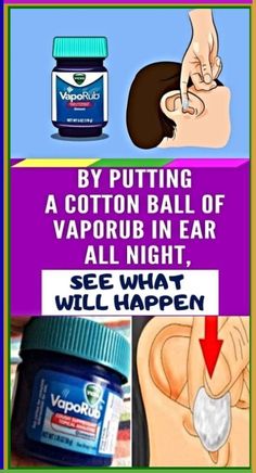 By Putting A Cotton Ball Of VapoRub In Ear All Night, See What Will Happen.. Ear Ache, Sinus Headache, School Communication, Creating A Newsletter, Fitness Advice, Cotton Ball, Health And Fitness Tips