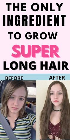 Looking for ways to grow hair faster naturally? Hair is a very important part of the human body and growing your hair faster is a great way to get the look you want. But it can also be a lot of work. So whether you want thick, full, shiny hair or just a little length here and there, we hope this guide makes your journey easier. Here, we take a look at some of the most popular and effective hair growth tips faster at home. Included how to grow hair faster in a week for black women Ways To Grow Hair Faster, Grow Hair Longer Faster, Hair Longer Faster, Hair Growth Black Hair, Tips To Grow Hair, Hair Growth Masks, Faster Hair Growth Tips, Grow Hair Naturally, Hair Wont Grow