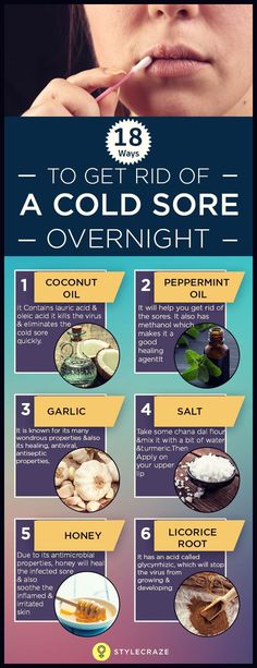 You woke up this morning, and suddenly, you notice a cold sore on your lips. Wondering how to get rid of a cold sore overnight? Worry not, you are at the right place Cooking With Turmeric, Get Rid Of Cold, Canker Sore, Cold Sores Remedies, Diy Remedies, Woke Up This Morning, Cold Sore