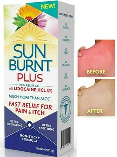 SunBurnt PLUS Pain Relief Gel for After Sun, 5 oz - Non-sticky Pain Relief with Lidocaine, Aloe, Calendula FAST PAIN RELIEF ORGANIC ALOE VERA GEL: SunBurnt Plus Pain Relief Gel provides immediate pain relief / itch relief for hot, dry sunburned skin NON-STICKY AFTER-SUN ALOE GEL: SunBurnt absorbs quickly into your skin, leaving hot, dry skin feeling hydrated and silky smooth LOVE YOUR SKIN: SunBurnt is Dermatologist tested and contains zero sulfates, parabens, glycols, phthalates, dyes or fragra Spa Stuff, Pain Relief Gel, Organic Aloe Vera Gel, Sun Burn, Itch Relief, Aloe Gel, Tybee Island, Love Your Skin