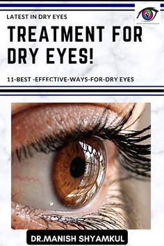 Dry eyes treatment -Number of treatment approaches are used for the cure of dry eyes. Learn about dry eyes and treatment of dry eyes and latest in dry eye cure. Dry Eye Remedies, Eye Health Remedies, Best Eye Drops, Chronic Dry Eye, Home Remedies For Allergies, Natural Remedies For Migraines, Eye Problems, Dry Eyes Relief, Dry Skin Remedies