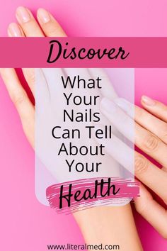 White Spots On Fingernails, White Spots On Toenails, Nails And Health, Nail Health Problems, White Spots On Nails, Bad Nails, Nails Health, Healthy Life Hacks, Health Signs