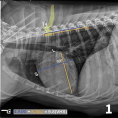 an x - ray shows the chest and shoulder area with arrows pointing in different directions