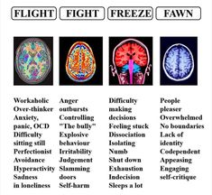 Nervus Vagus, The Human Brain, Brain Science, Dissociation