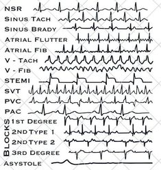 EKG Strip file for the cardiac lover in your life.  This is a DIGITAL SVG FILE ONLY, no physical item will be sent.  - Once you have completed your purchase, a link to download will be sent to the e-mail account registered to your Etsy account. - Design can be downloaded and cut with any silhouette, cricut, or other scan and cut. - Please do not resell or share the digital files. ⚠️ - Digital files CANNOT BE REFUNDED. If you have any problems, concerns and queries with your downloads, feel free Cardiac Sonography, Nursing School Inspiration, Medical Assistant Student, Paramedic School, Nursing School Essential, Nursing School Motivation, Medical School Life, Nurse Study Notes, Nursing Student Tips