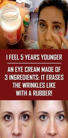 Homemade Eye Cream, Years Younger, Eye Care, An Eye, 3 Ingredients, Eye Cream, Beauty Secrets, Diy Beauty, Beauty Care