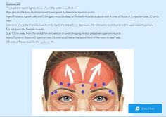 Botox Supplies, Post Botox Instructions, Botulinum Toxin Injection, Botox Brow Lift Injection Site, Botox Memes Funny, Brow Threading, Eyebrow Lift