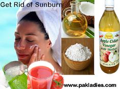 Face Sunburn Remedies, Sunburn On Face, Vinegar For Sunburn, Best For Sunburn, Sunburn Face, Sunburnt Face