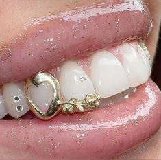 Grills For Girls Teeth, Butterfly Grills, Gold Grillz Aesthetic, Grills For Women Teeth Gap, Grill Design Teeth, Grillz For Females Aesthetic, Baddie Grillz, Cute Grills, Women Grills