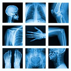 multiple x - ray images of the human body showing bones and hands, including the upper half of the skeleton