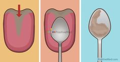 If you could determine the state of your internal health for free, with a simple kitchen utensil, would you? All you would need is a spoon, a plastic bag, your own mouth, and 60 seconds. Candida Albicans, Tongue Health, Health Check, Health Info, Natural Medicine, Health Professionals, Chakra Healing, Oral Health, Body Health