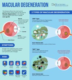 Macular Degeneration: Causes, Symptoms & Natural Support Strategies Liver Support, Vision Loss, Healthy Eyes