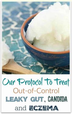 Coconut Oil To Treat Leaky Gut, Candida, [& Surprisingly Diabetes]. Serious help for leaky gut, eczema and serious overgrowth of candida albicans. #recipes #healthy #food #wellness #healthyrecipes #medicine #health #fitness #healing #antiaging #natural #naturalremedies #fitnessaddict #wisdom #faith #kids #coconutoil #mentalhealth #candida #leakygut #antiinflammatory #adhd #gaps Food Wellness, Heal Leaky Gut, Bad Bugs, Candida Diet Recipes, Candida Cleanse, Candida Overgrowth, Holistic Health Remedies, Candida Albicans, Candida Diet