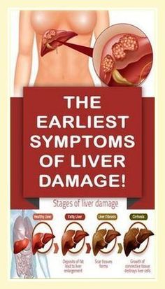 Learn about the 10 crucial warning signs of liver damage, including jaundice, swelling, and dark urine. Recognizing these symptoms early can help prevent serious liver diseases and improve your chances for effective treatment.