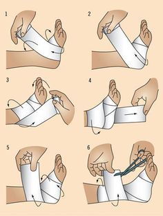 How To Wrap An Ankle With An Ace Bandage, Wrapping Ankle Injury, Survival Skills Emergency Preparedness, First Aid Tips, Trening Sztuk Walki, Sports Therapy, Survival Skills Life Hacks, Kinesiology Taping, Medical School Essentials