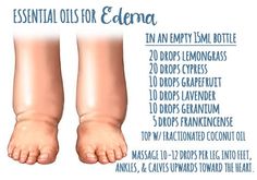 Best Essential Oils For Skin, Essential Oils For Skin Care, Oils For Skin Care, Terra Essential Oils, Essential Oil Remedy, Yl Oils, Oil Remedies, Essential Oils Herbs