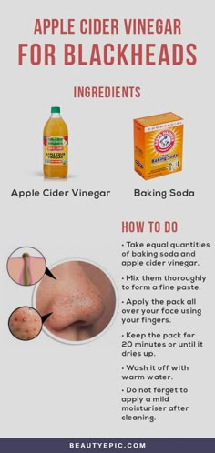 Canned Apples, Apple Vinegar, Rid Of Blackheads, For Blackheads, Organic Apple Cider, Get Rid Of Blackheads, Beauty Tricks, Blackhead Remover, Beauty Ideas