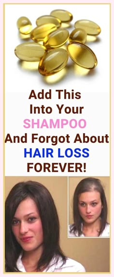 Grow Hair Faster, Hair Remedies, Hair Treatments, Natural Beauty Tips, Thinning Hair, Spicy Recipes, Grow Hair, Hair Health