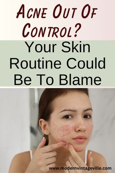 Acne is more than a skin issue—it’s a confidence killer.

 Painful and persistent breakouts might be caused by everyday skincare mistakes. In this blog post, learn how clean beauty can transform your skin and help you regain your glow.

 Click to read the ultimate guide for acne-prone skin. Cinnamon Face Mask, Skincare Mistakes, Green Tea Face, Everyday Skincare, Homemade Hair Products, Acne Breakout, Acne Spots, Common Myths, Skin Routine