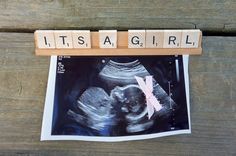 the word it's a girl spelled out with scrabbles in front of an x - ray