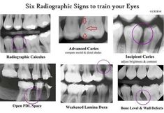 Dental Assistant School, Dental Hygienist School, Dental Hygiene Student, Dental World, Kedokteran Gigi, Dental Hygiene School, Dentistry Student