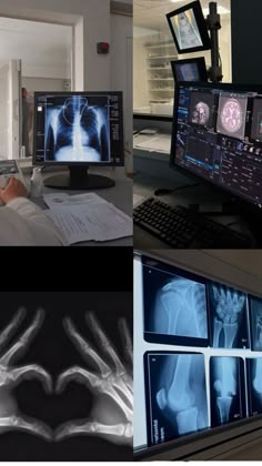 there are many different images of medical equipment in this photo, including an x - ray