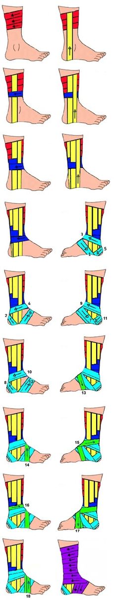 Every soccer player should know this. #SportabellaLove Ankle Taping, K Tape, Athletic Trainer, Soccer Life, Athletic Training, Sports Injury, Sports Medicine, Survival Tips, Emergency Preparedness