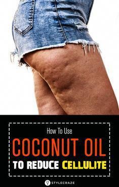 Using coconut oil for cellulite is one of the simplest ways to treat this skin condition. Try the following 5 methods to achieve quicker and effective results! Beauty Diy, Fat Removal, Do Exercise, Aerobic Exercise, Skin Conditions, Easy Workouts, Doterra, Natural Remedies, Beauty Tips