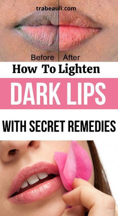 Is your searching for how to get rid dark lip fast? If yes, so here effective natural home remedies for pink lips at home that will make soft Orange Peel Benefits, For Pink Lips, Lighten Dark Lips, For Dark Lips, Home Remedies For Pimples, Unhealthy Diet, Health Signs, Pigmented Lips, Healthy Liver