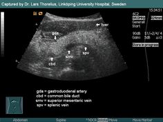 Ultrasound Technician School, Diagnostic Medical Sonography Student, Ultrasound School, Obstetric Ultrasound, Sonography Student, Ultrasound Sonography, Medical Ultrasound, Ultrasound Technician