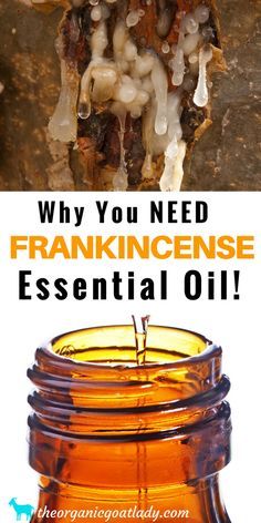 Frankincense Essential Oil, Aromatherapy Recipes, Essential Oil Recipes, Essential Oil Diffuser Blends Frankincense Essential Oil Benefits, Essential Oil Frankincense, Frankincense Essential Oil Uses, Nutmeg Essential Oil, Turmeric Essential Oil, Aromatherapy Recipes, Diffuser Oil, Essential Oils Herbs, Essential Oils Health