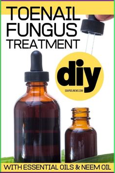 This natural toenail fungus treatment can be made at home and clears up unsightly toenail fungus without chemicals for a super effective home remedy. Diy Antifungal Cream, Toenail Fungus Essential Oils, Nail Remedies, Antifungal Cream, Toenail Fungus Remedies, Nail Fungus Remedy, Natural Recipes, Vapor Rub, Foot Scrub