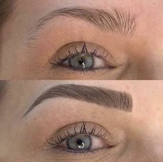 Forehead Lift, Bad Eyebrows, Women Artist, Mary Kay Skin Care, Beauty Eyebrow, Dark Spots On Face, Beautiful Eyebrows