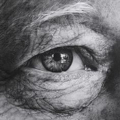 black and white photograph of an eye with wrinkles on the upper part of the iris