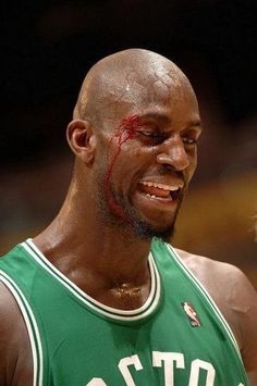 a basketball player with blood on his face