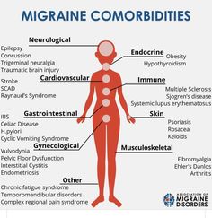 Types Of Migraines, Migraine Diet, Migraine Help, Occipital Neuralgia, Pelvic Floor Dysfunction, Migraine Pain, Complex Regional Pain Syndrome