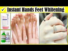 100% Effective Hands and Feet Whitening Remedy.Parlor Secret Hand & Foot Whitening Cream.Hy Friends.I have Shared many Skin Whitening Remedies before. Today'... Feet Whitening, Beauty Tips In Hindi, Beauty Tips In Urdu, Hand And Foot Care, Beauty Tips For Face, Beauty Tips For Skin, Winter Skin, Whitening Cream, Health And Beauty Tips